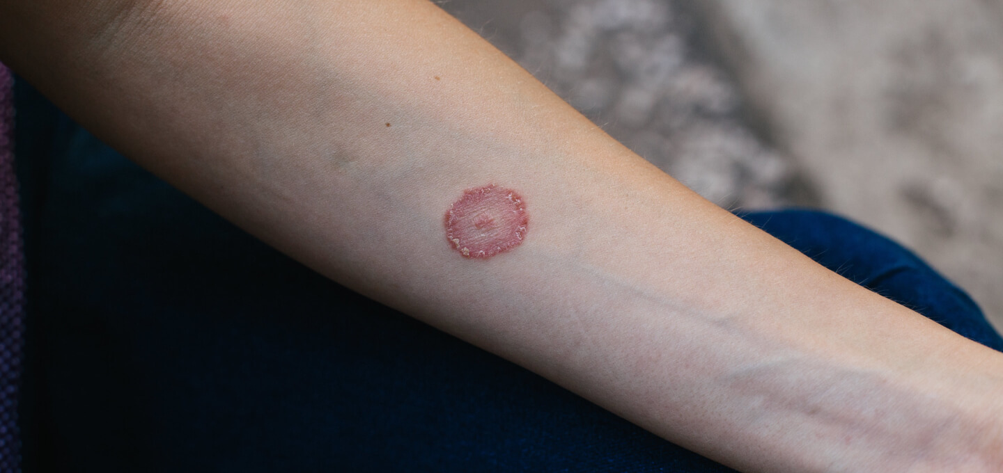 A woman with a tattoo on her arm.