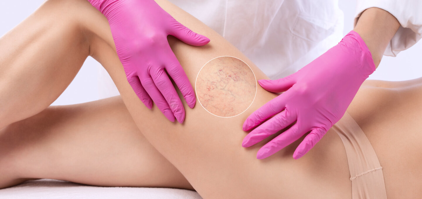 A woman in pink gloves is getting her thigh waxed.
