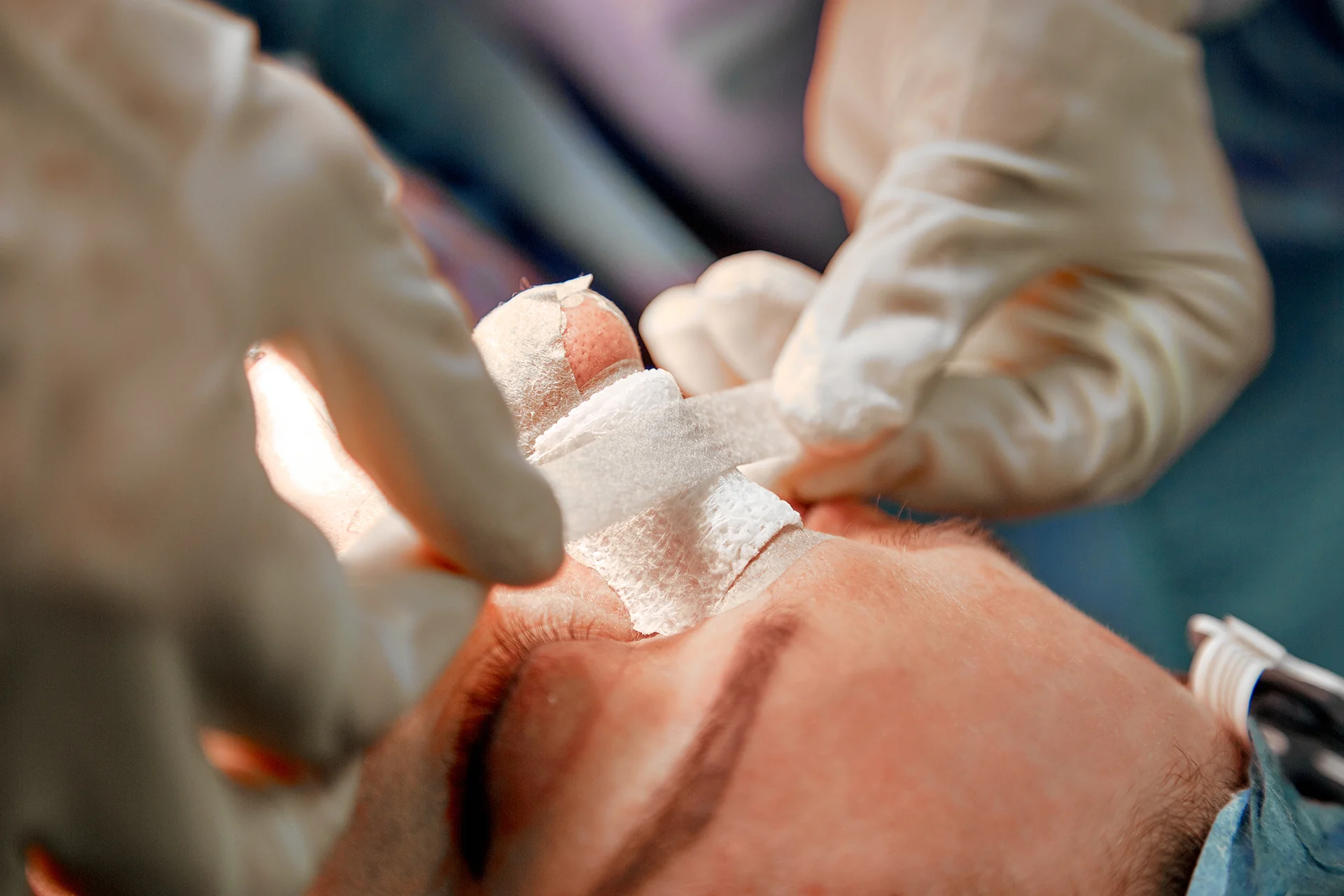 a surgeon trying to bandage a nose after Mohs surgery