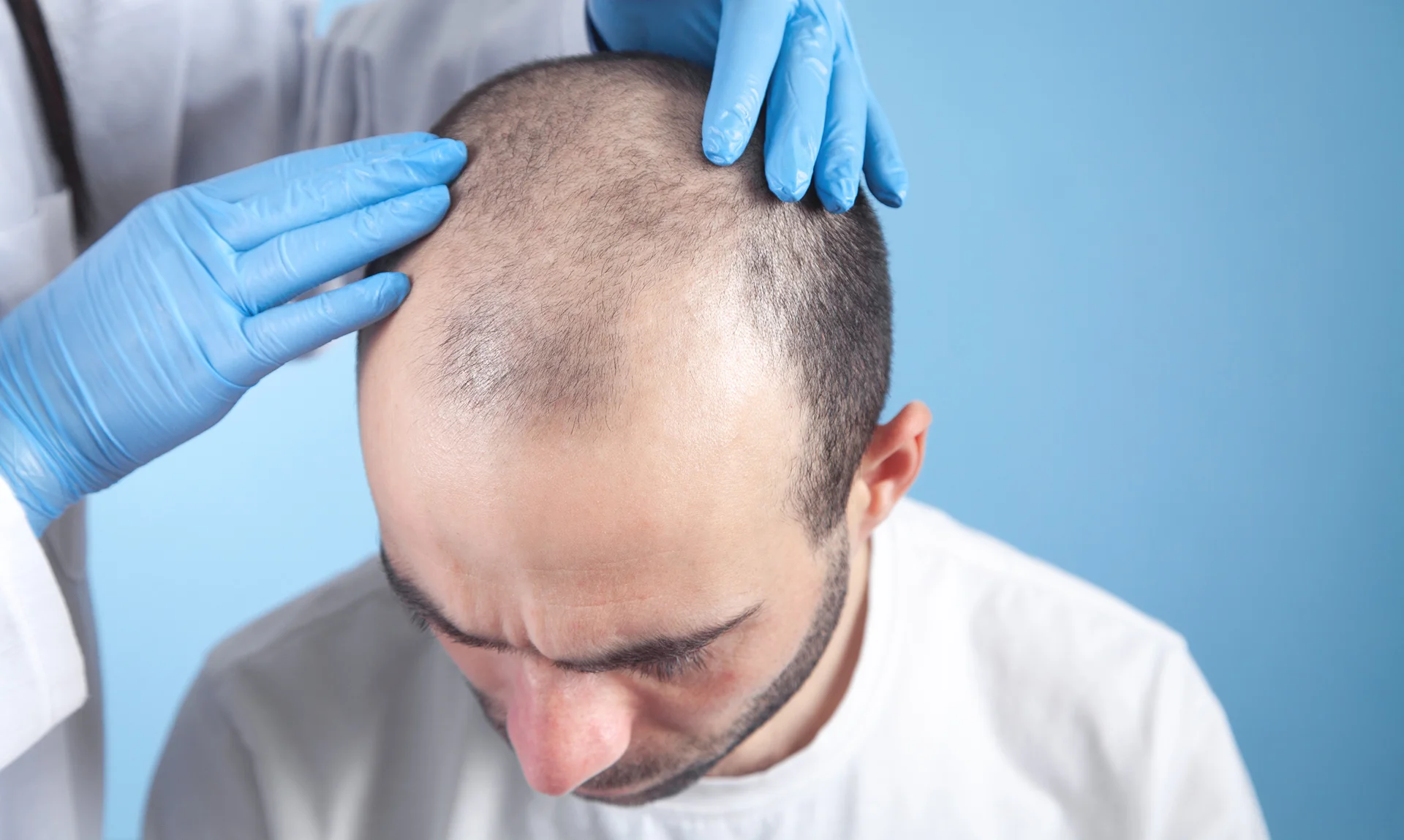 Will My Hair Grow Back After Mohs Surgery on Scalp? | Dermatology and Skin  Health - Dr. Mendese