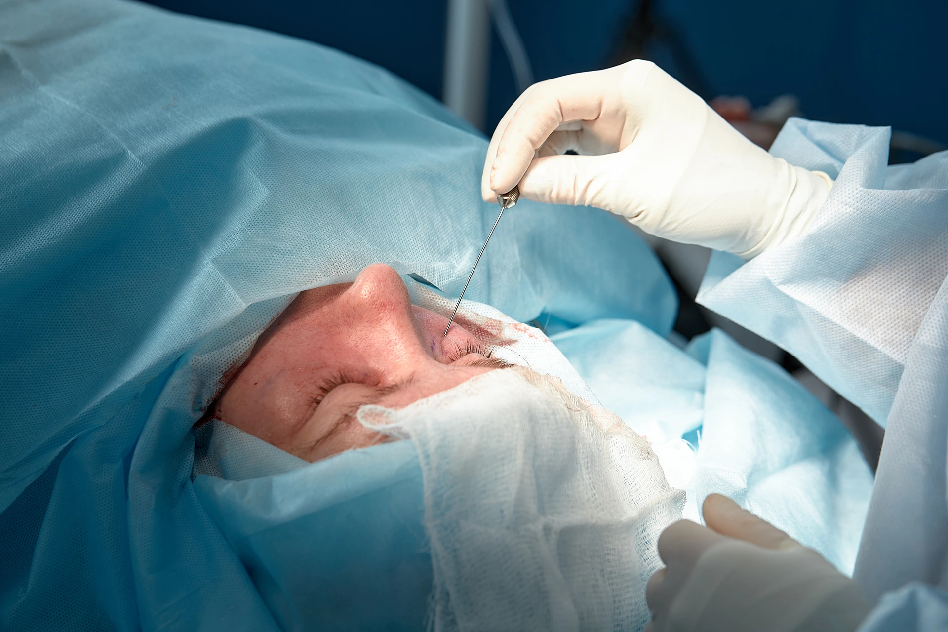 A person being operated on in an operating room.