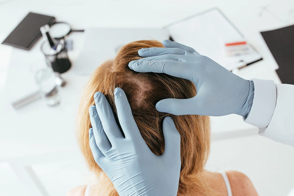 A doctor is examining a woman's hair.