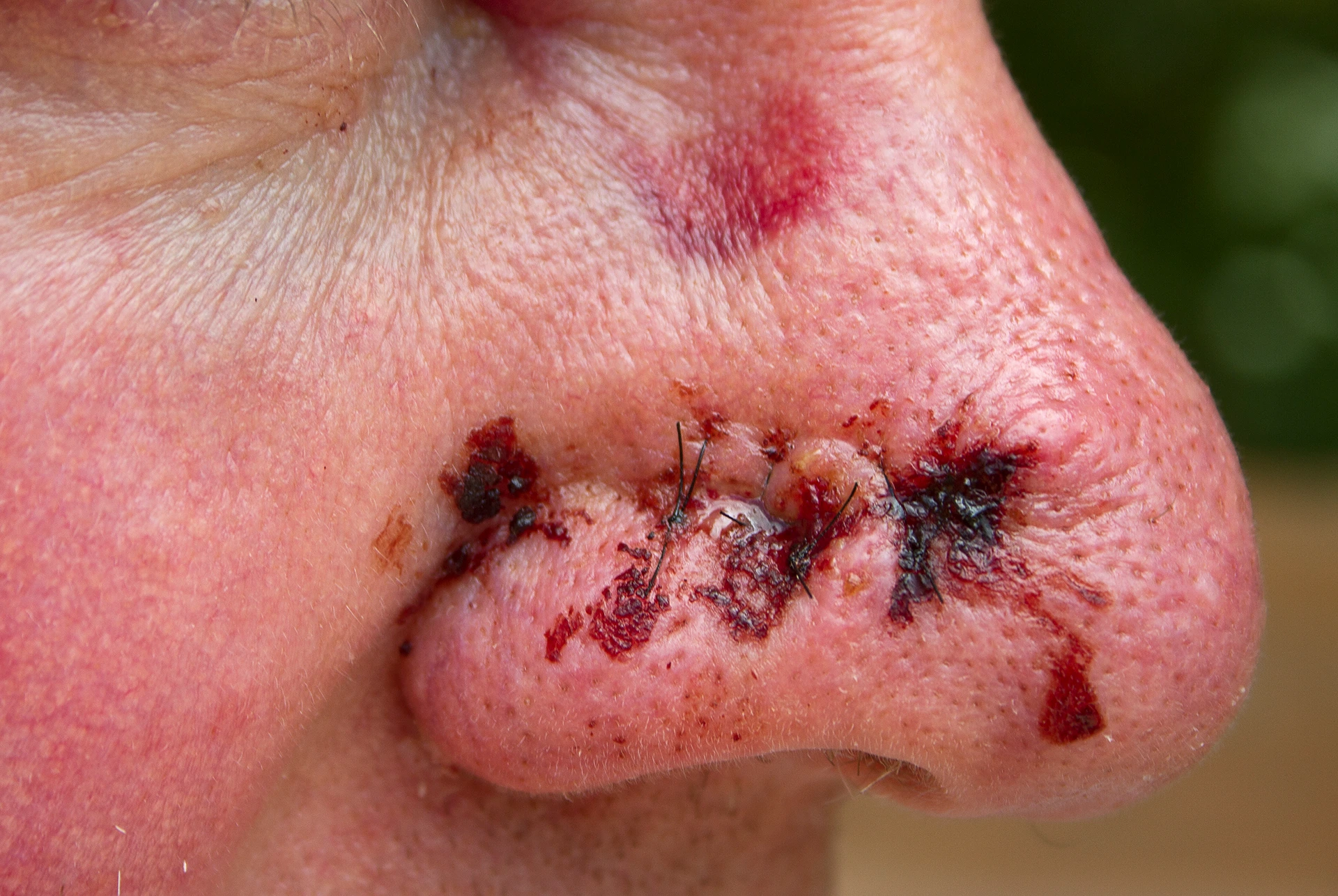 A close up of a man's nose with blood on it.