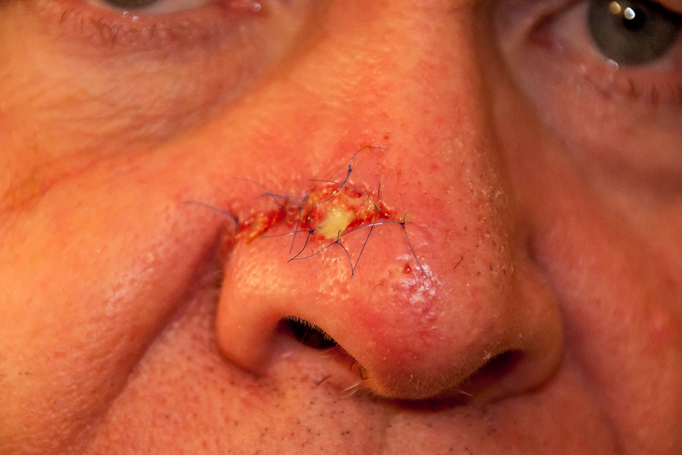 A close up of a man's nose.