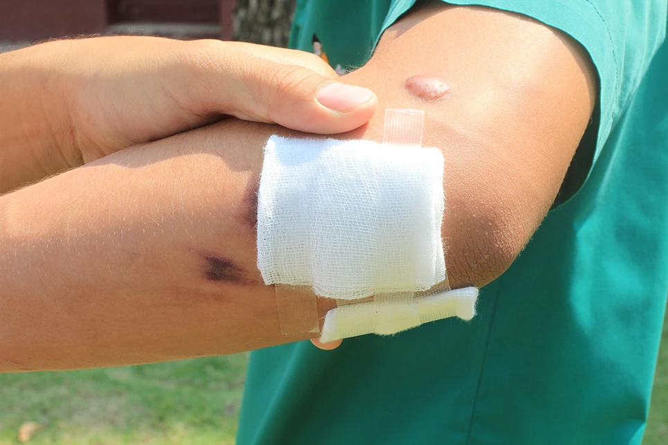 A person with a bandaged forearm displaying a minor injury or medical procedure site.