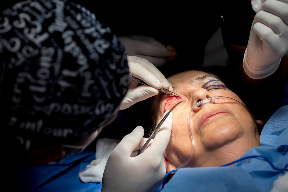 A patient undergoing an eye procedure with a surgeon and assistant at work.