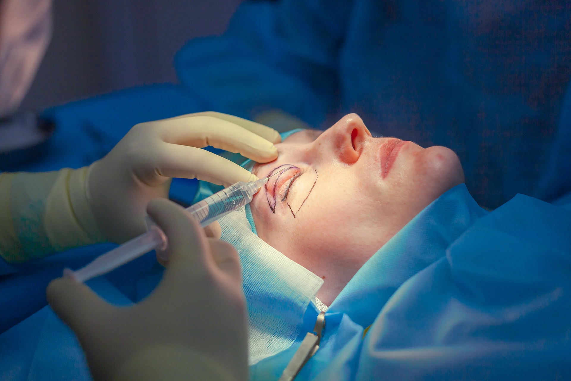 A patient undergoing a cosmetic procedure with injections around the eye area.
