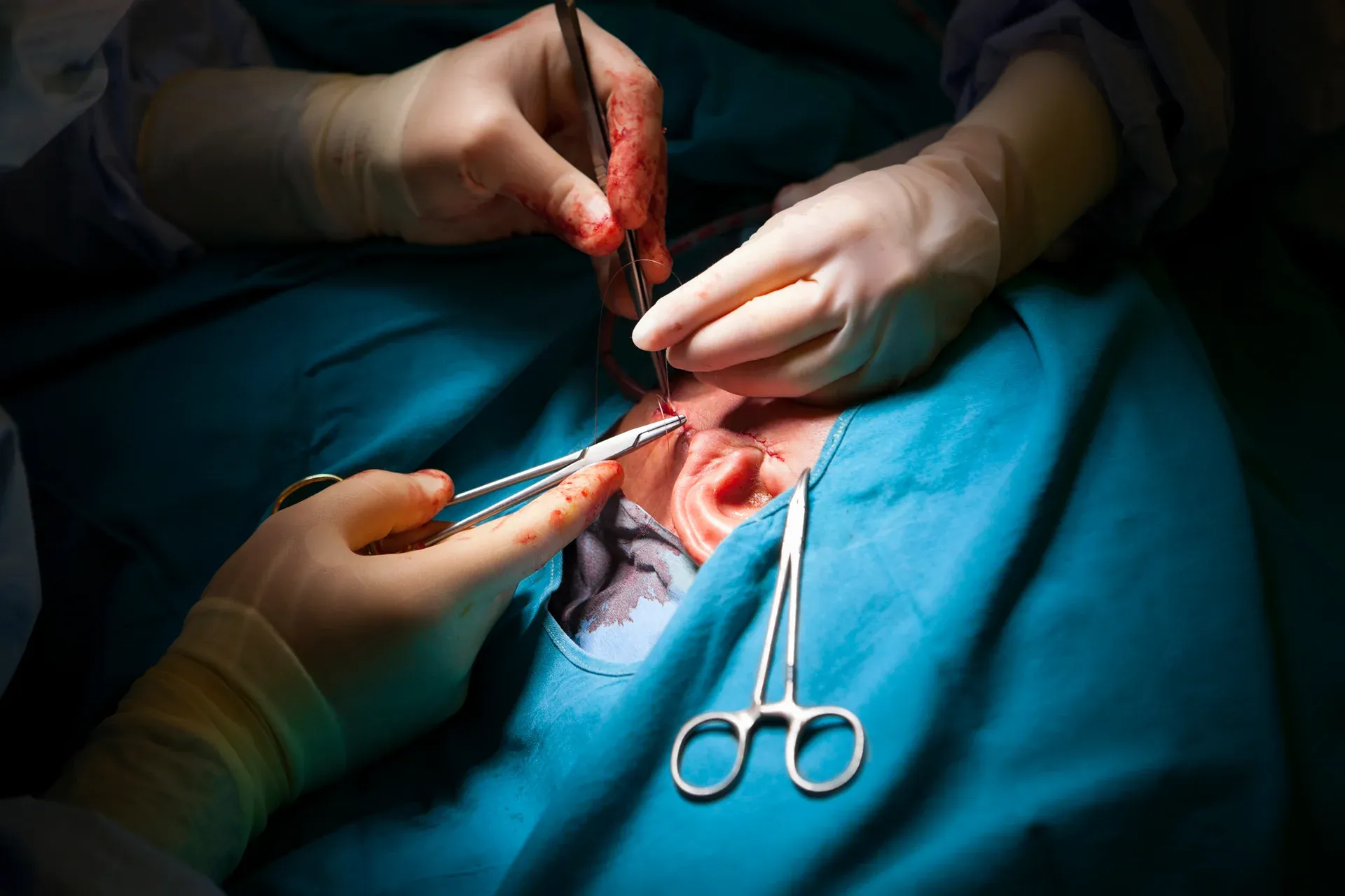 Surgeons performing an operation on a patient with surgical instruments in use.