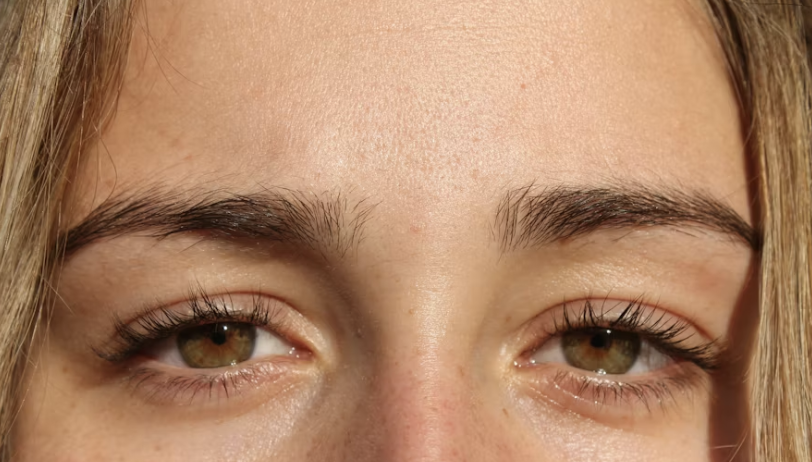Female forehead