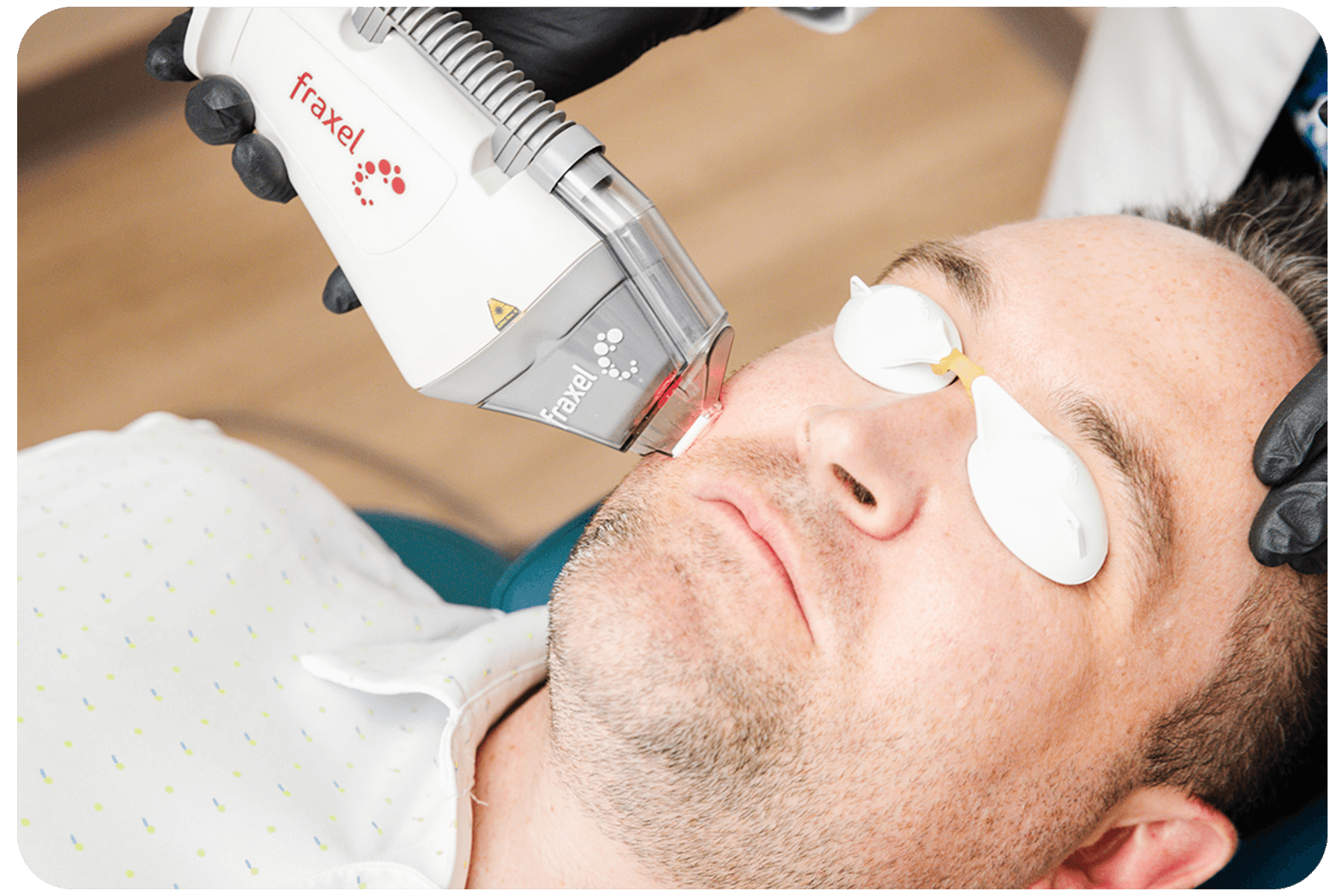 Fraxel Laser treatment on man's face