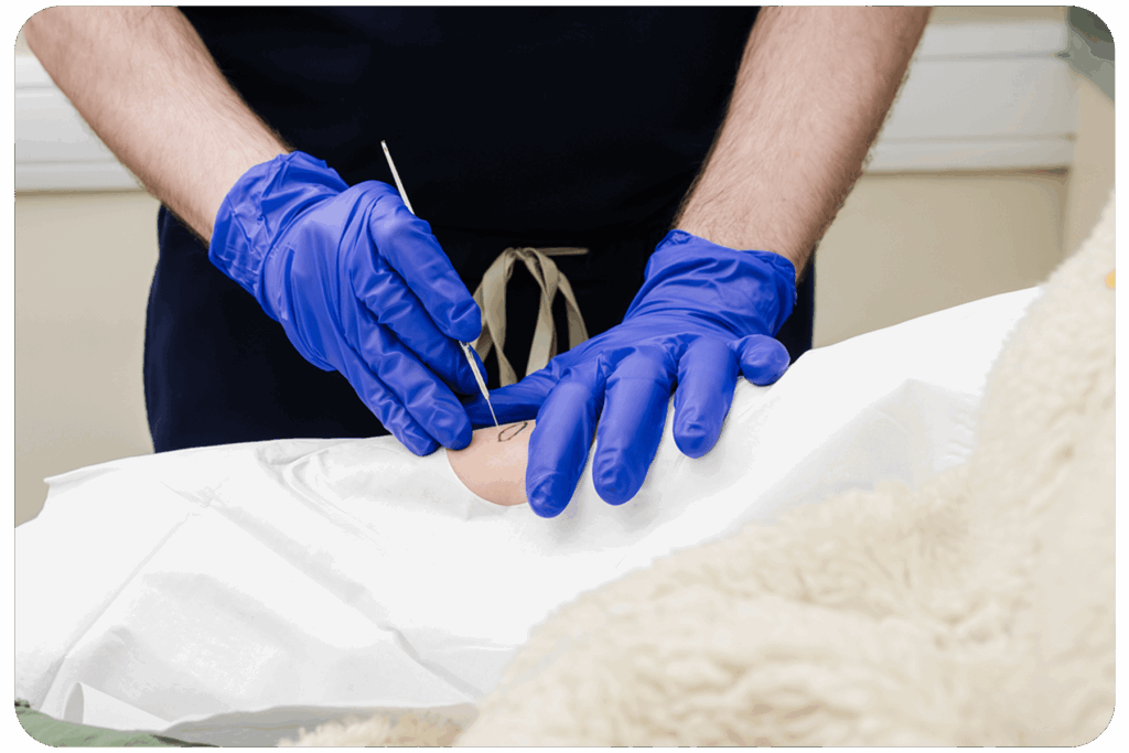 Dermatologist removing skin cancer