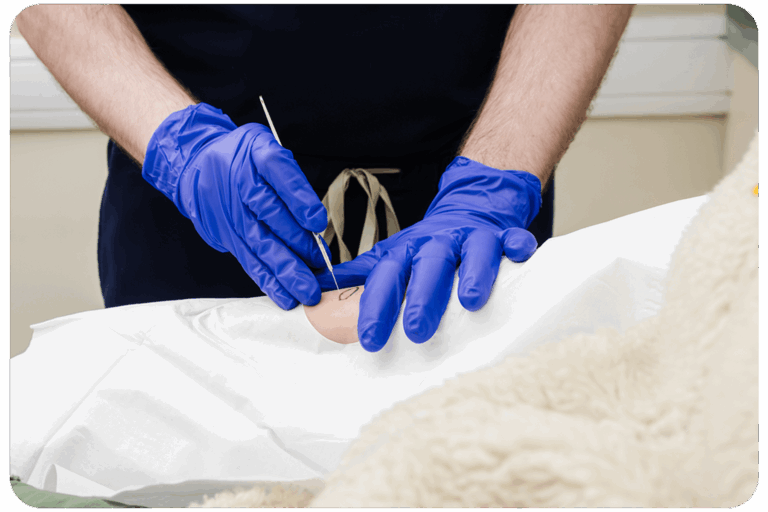 Dermatologist removing skin cancer