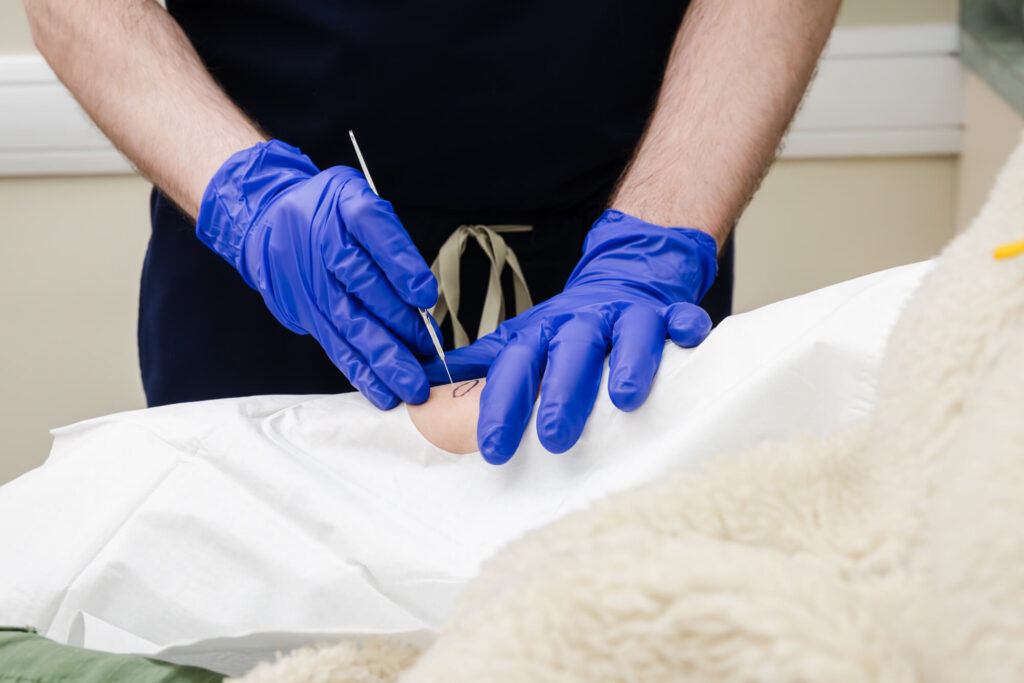 Skin cancer being removed