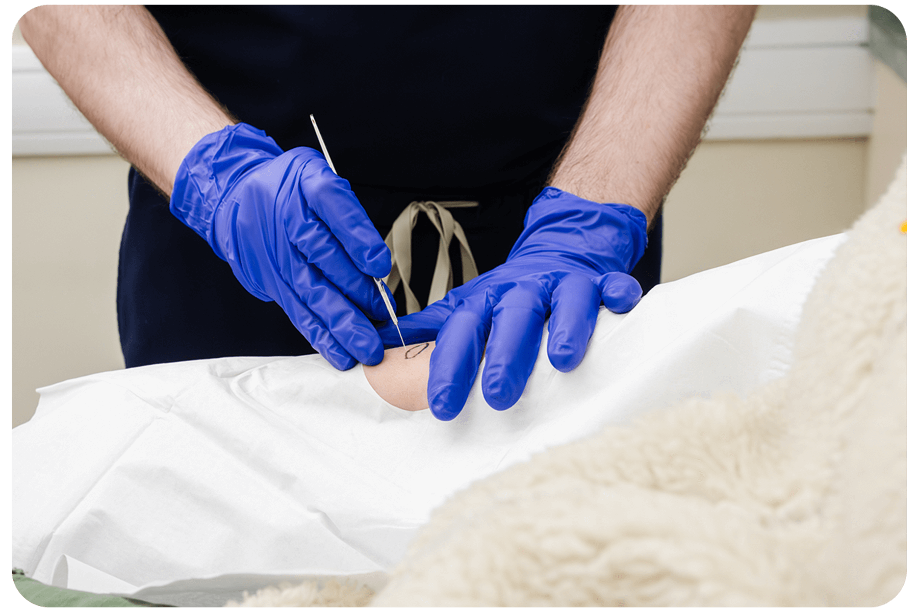 Dermatologist removing skin cancer