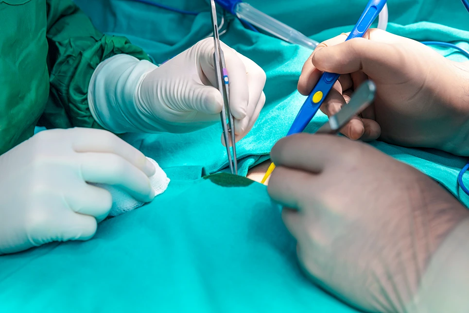 A surgical team performing an operation with a focus on the hands and instruments.
