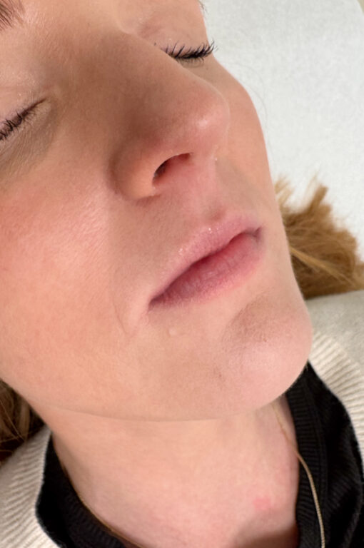 Patient laying with eyes closed