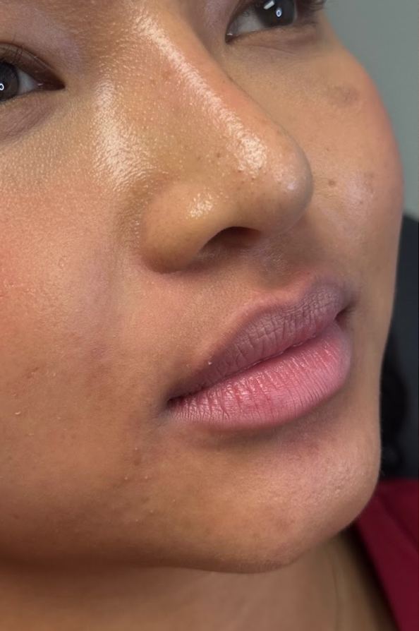 Patient lips close up of face